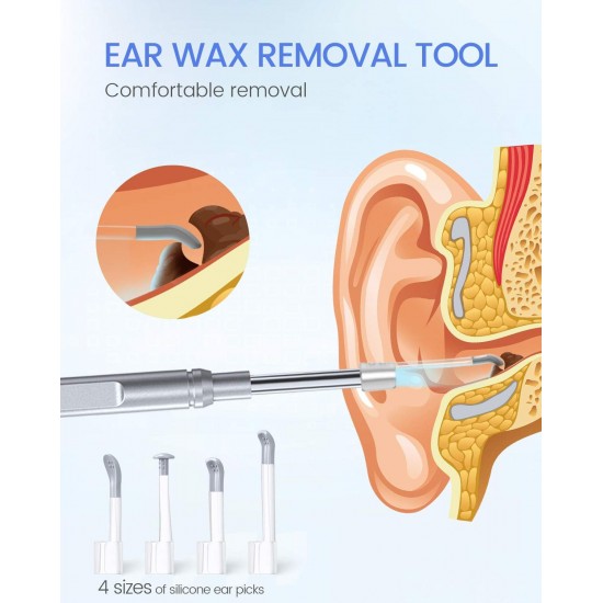 جهاز تنظيف الأذن بكاميرا الجديد