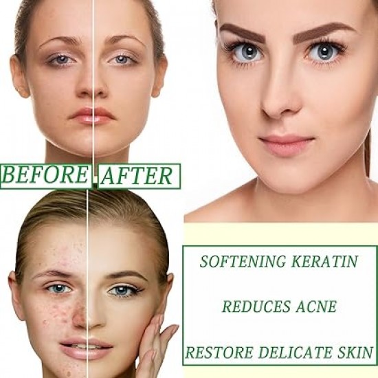 ماسك الوجه بالشاي الأخضر