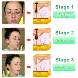 جل QUARXERY لتجديد الجسم وتقشيره