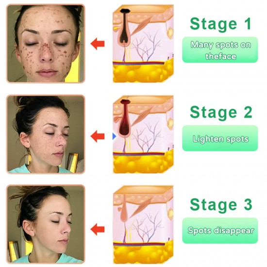 جل QUARXERY لتجديد الجسم وتقشيره