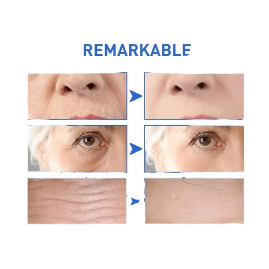 سيرم الكولاجين مضاد الشيخوخة الجديد