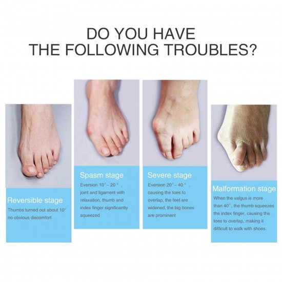 شراب فاصل مصحح إعوجاج اصبع القدم