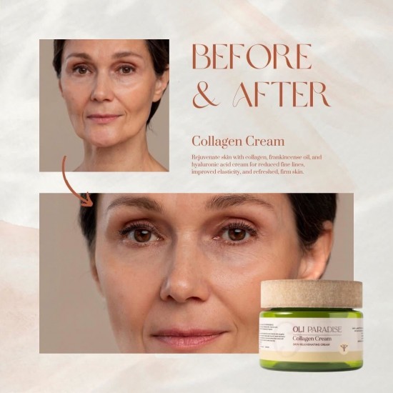 اولي باراديس كولاجين