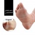 عرض حافظه تلج للكدمات داعم الكاحل المغنطيسي