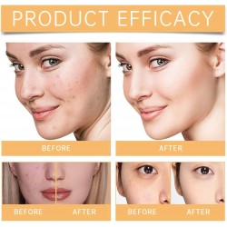 The Ordinary Glycolic Acid