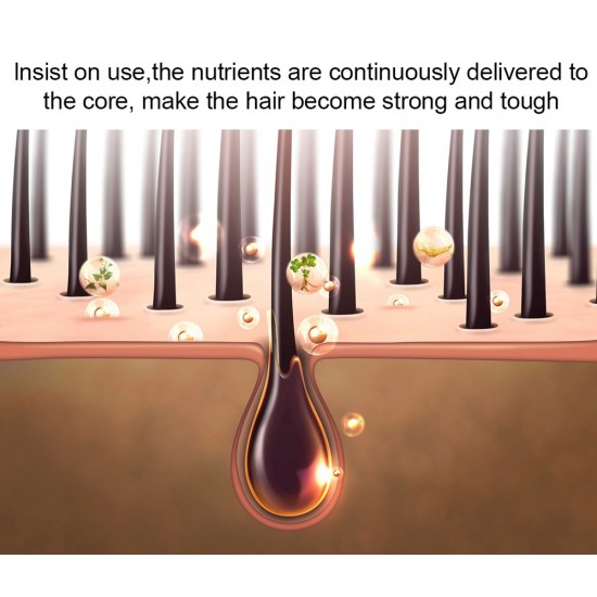 حقيبة الظهر