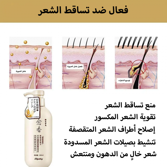 فستان الدانتيل الاسود